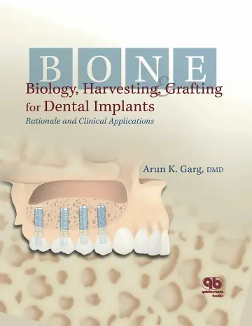 Cover of Bone Biology, Harvesting and Grafting for Dental Implants