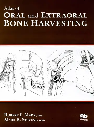 Cover of Atlas of Oral and Extraoral Bone Harvesting