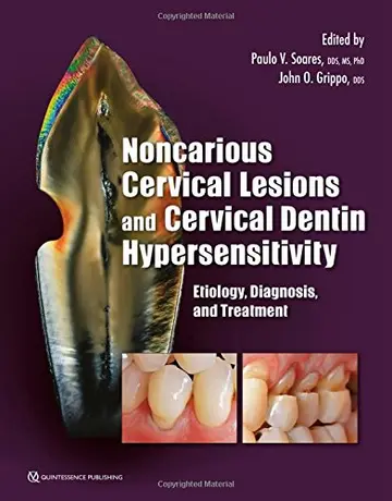 Cover of Noncarious Cervical Lesions and Cervical Dentin Hypersensitivity