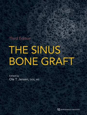 Cover of The Sinus Bone Graft
