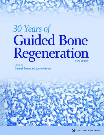 Cover of 30 Years of Guided Bone Regeneration (GBR), 3rd Edition