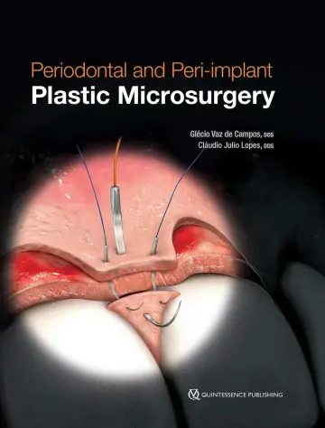 Cover of Periodontal and Peri-Implant Plastic Microsurgery