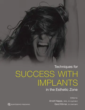 Cover of Techniques for Success with Implants in the Esthetic Zone