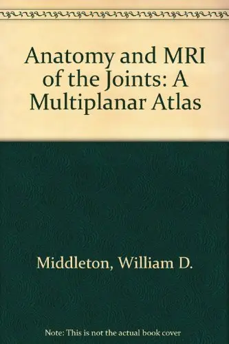 Cover of Anatomy and MRI of the Joints
