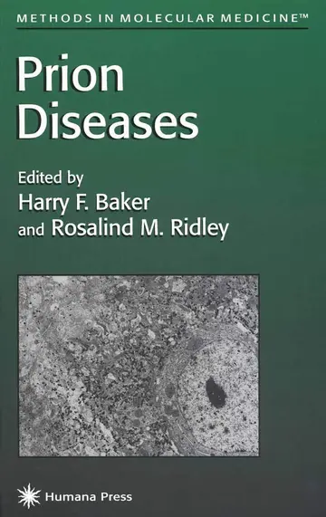 Cover of Prion Diseases