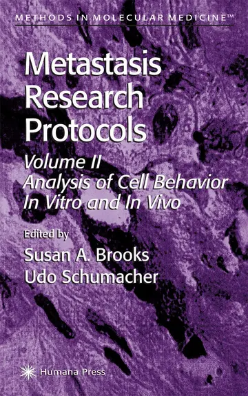 Cover of Metastasis Research Protocols