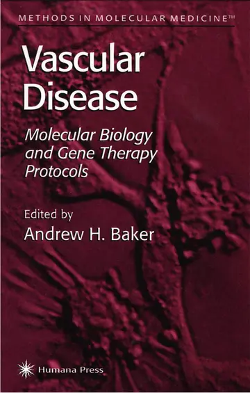 Cover of Vascular Disease