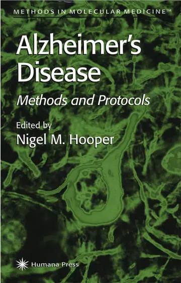 Cover of Alzheimer's Disease