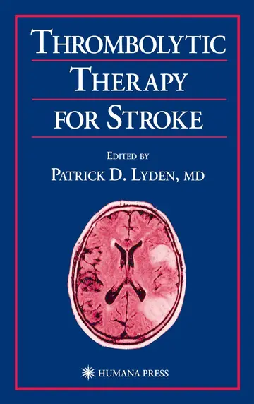 Cover of Thrombolytic Therapy for Stroke