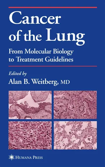 Cover of Cancer of the Lung