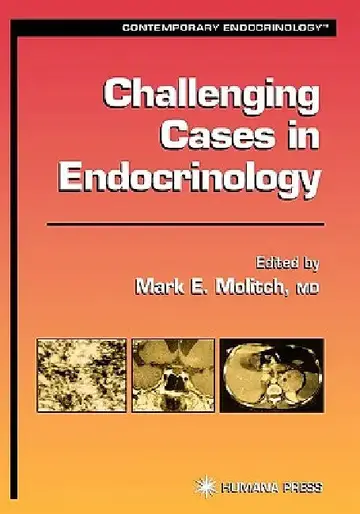 Cover of Challenging Cases in Endocrinology