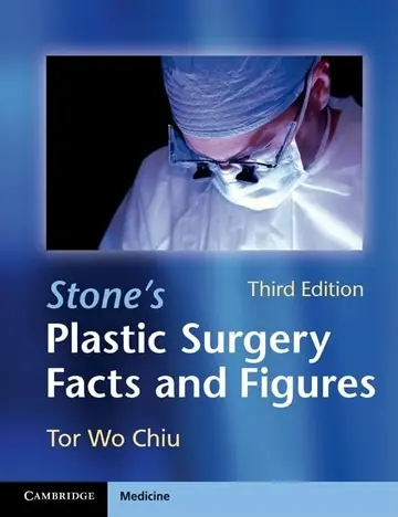 Cover of Stones Plastic Surgery Facts and Figures