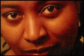 Cover of Skin