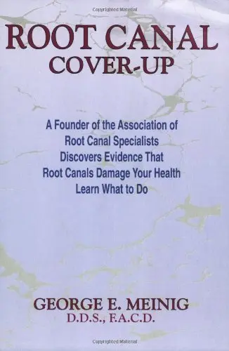 Cover of Root Canal Cover-Up