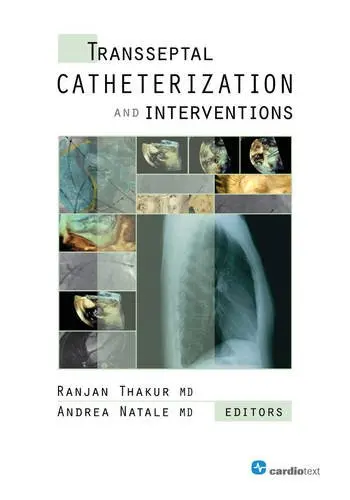 Cover of Transseptal Catheterization and Interventions