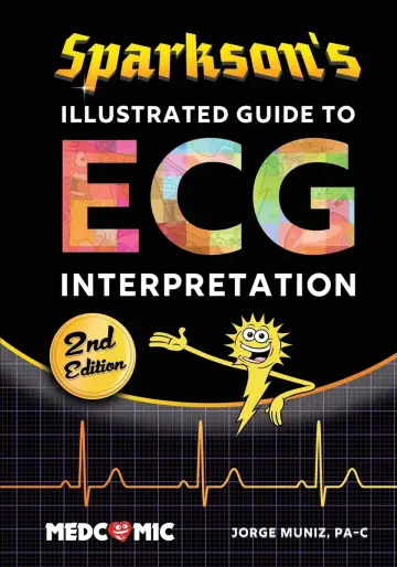 Cover of Sparkson's Illustrated Guide to ECG Interpretation, 2nd Edition