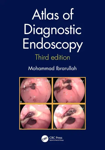 Cover of Atlas of Diagnostic Endoscopy, 3E