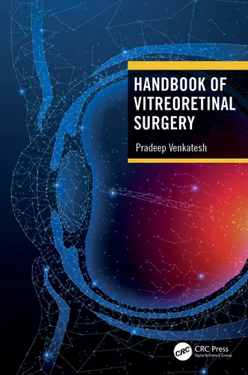 Cover of Handbook of Vitreoretinal Surgery