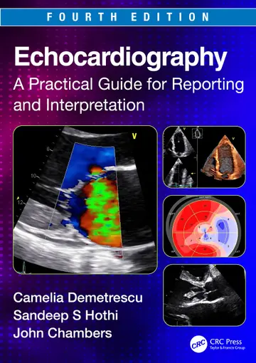 Cover of Echocardiography A Practical Guide for Reporting and Interpretation 4Ed