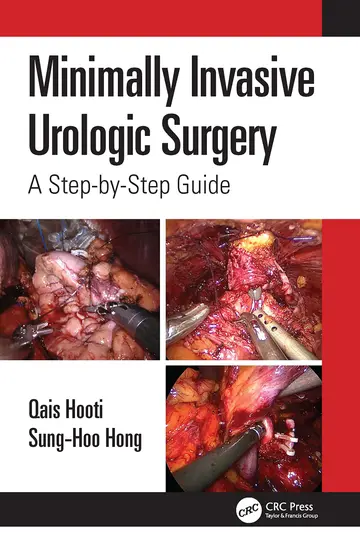 Cover of Minimally Invasive Urologic Surgery