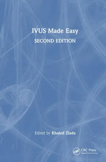 Cover of Ivus Made Easy