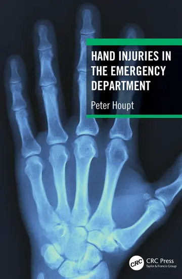 Cover of Hand Injuries in the Emergency Department