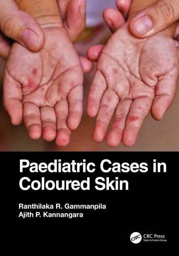 Cover of Paediatric Cases in Coloured Skin
