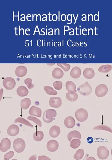 Cover of Haematology and the Asian Patient