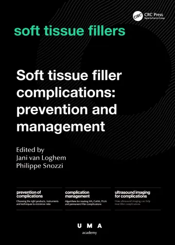 Cover of Soft Tissue Filler Complications Prevention and Management