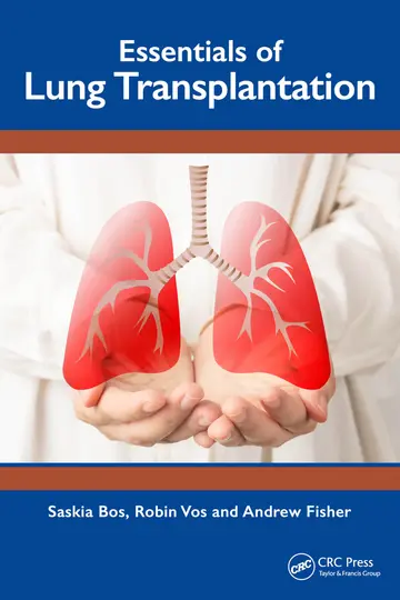 Cover of Essentials of Lung Transplantation