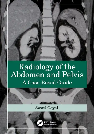 Cover of Radiology of the Abdomen and Pelvis