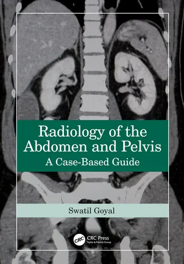 Cover of Radiology of the Abdomen and Pelvis