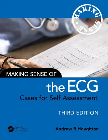 Cover of Making Sense of the ECG