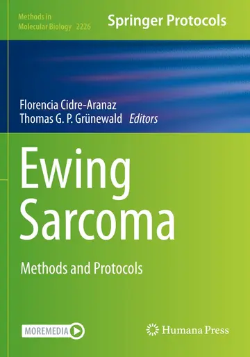 Cover of Ewing Sarcoma
