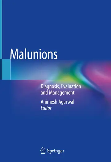 Cover of Malunions