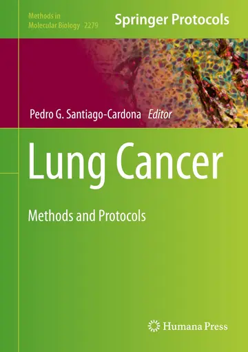 Cover of Lung Cancer