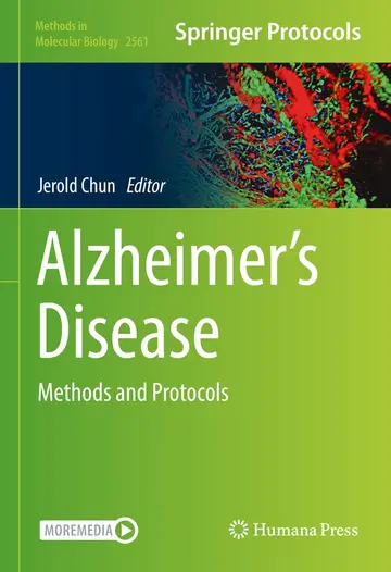 Cover of Alzheimer’s Disease