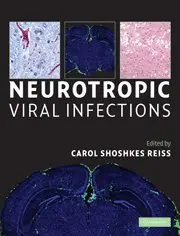 Cover of Neurotropic Viral Infections