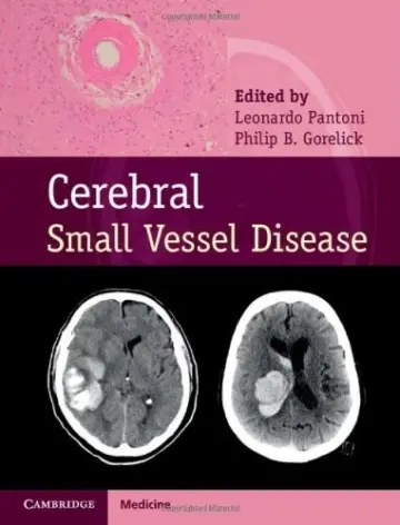 Cover of Cerebral Small Vessel Disease