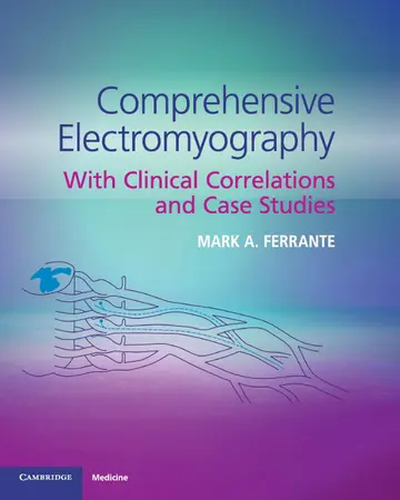 Cover of Comprehensive Electromyography