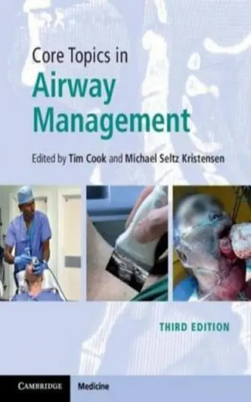 Cover of Core Topics in Airway Management Core Topics in Airway Management