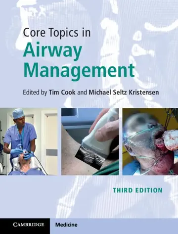 Cover of Core Topics in Airway Management