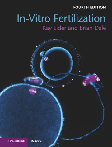 Cover of In-Vitro Fertilization