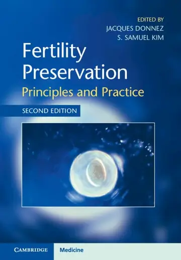 Cover of Fertility Preservation