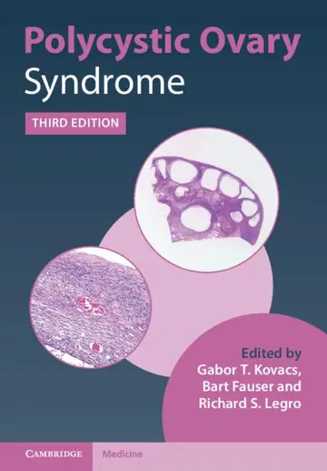 Cover of Polycystic Ovary Syndrome