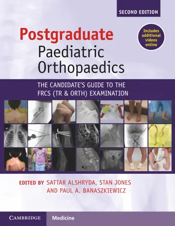 Cover of Postgraduate Paediatric Orthopaedics