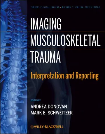 Cover of Imaging Musculoskeletal Trauma