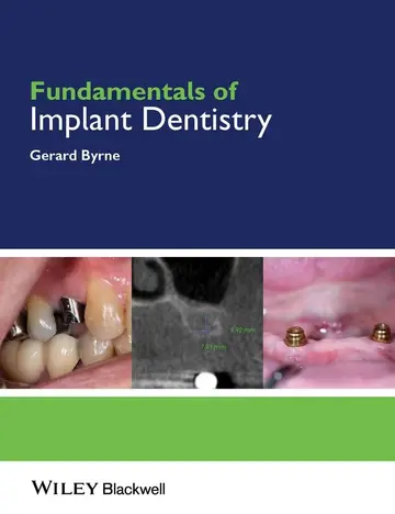 Cover of Fundamentals of Implant Dentistry