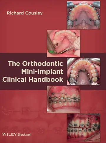 Cover of The Orthodontic Mini?implant Clinical Handbook