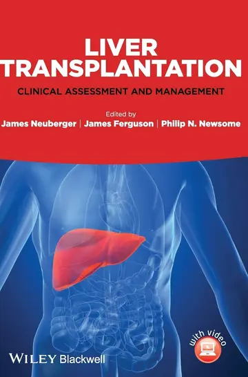 Cover of Liver Transplantation Clinical Assessment and Management